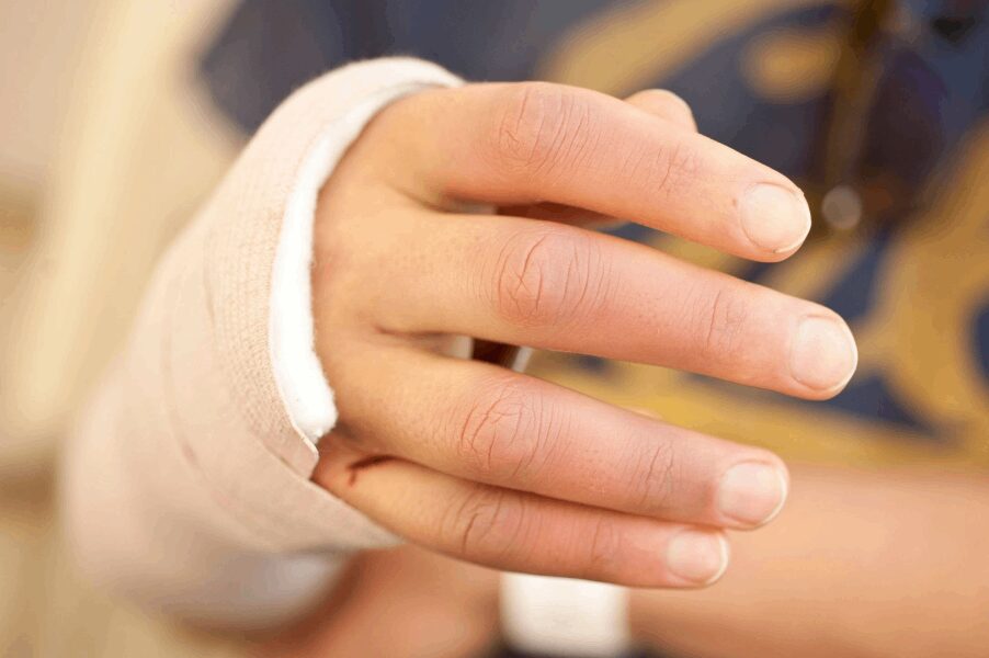 Patient's Hand With Plaster